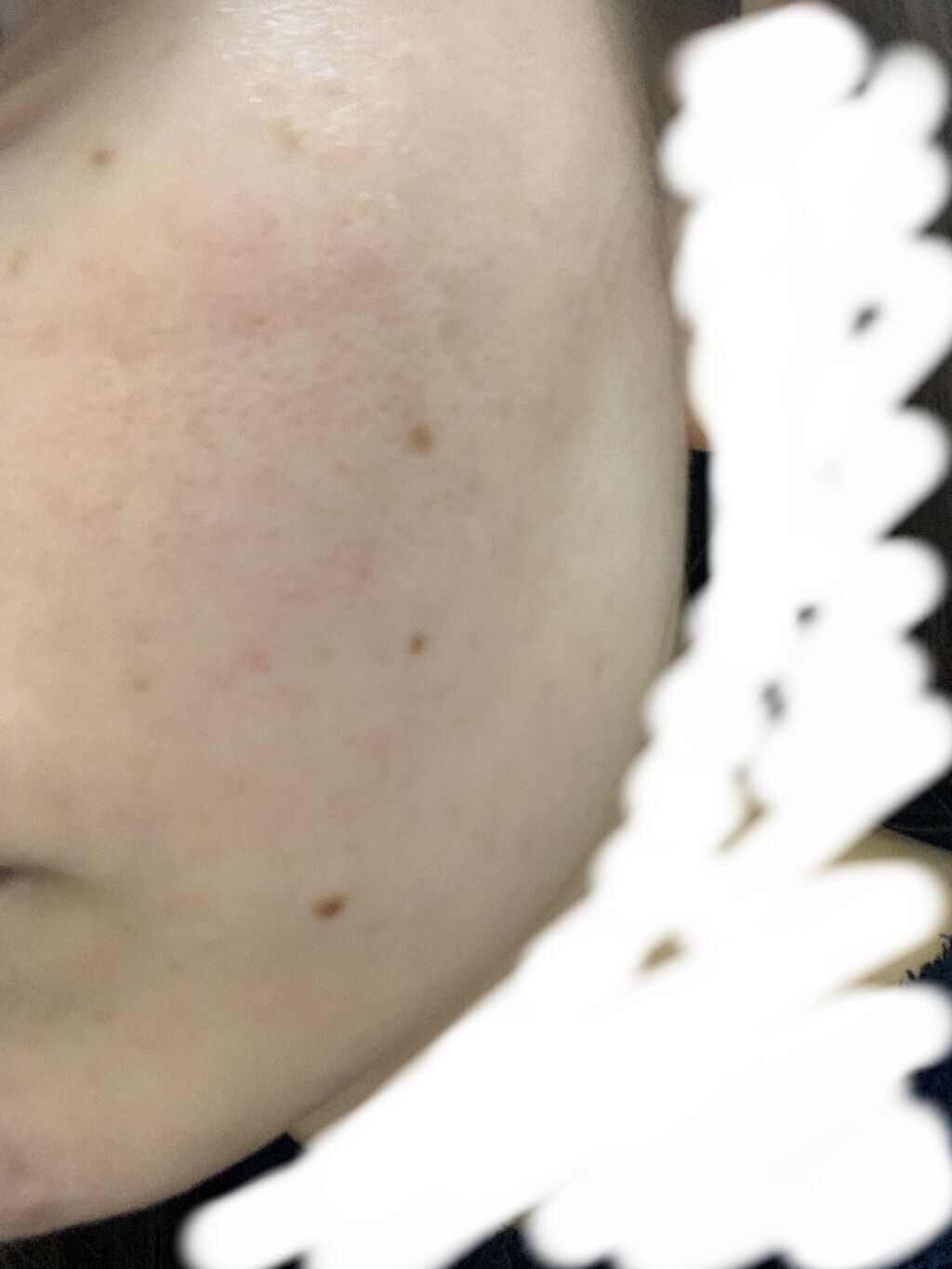 モイストバランス  ローション/ACSEINE/化粧水を使ったクチコミ（1枚目）