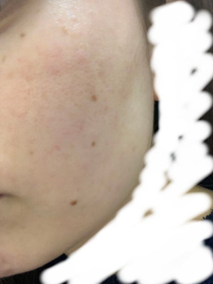 薬用エマルジョン/IHADA/乳液を使ったクチコミ(1枚目)