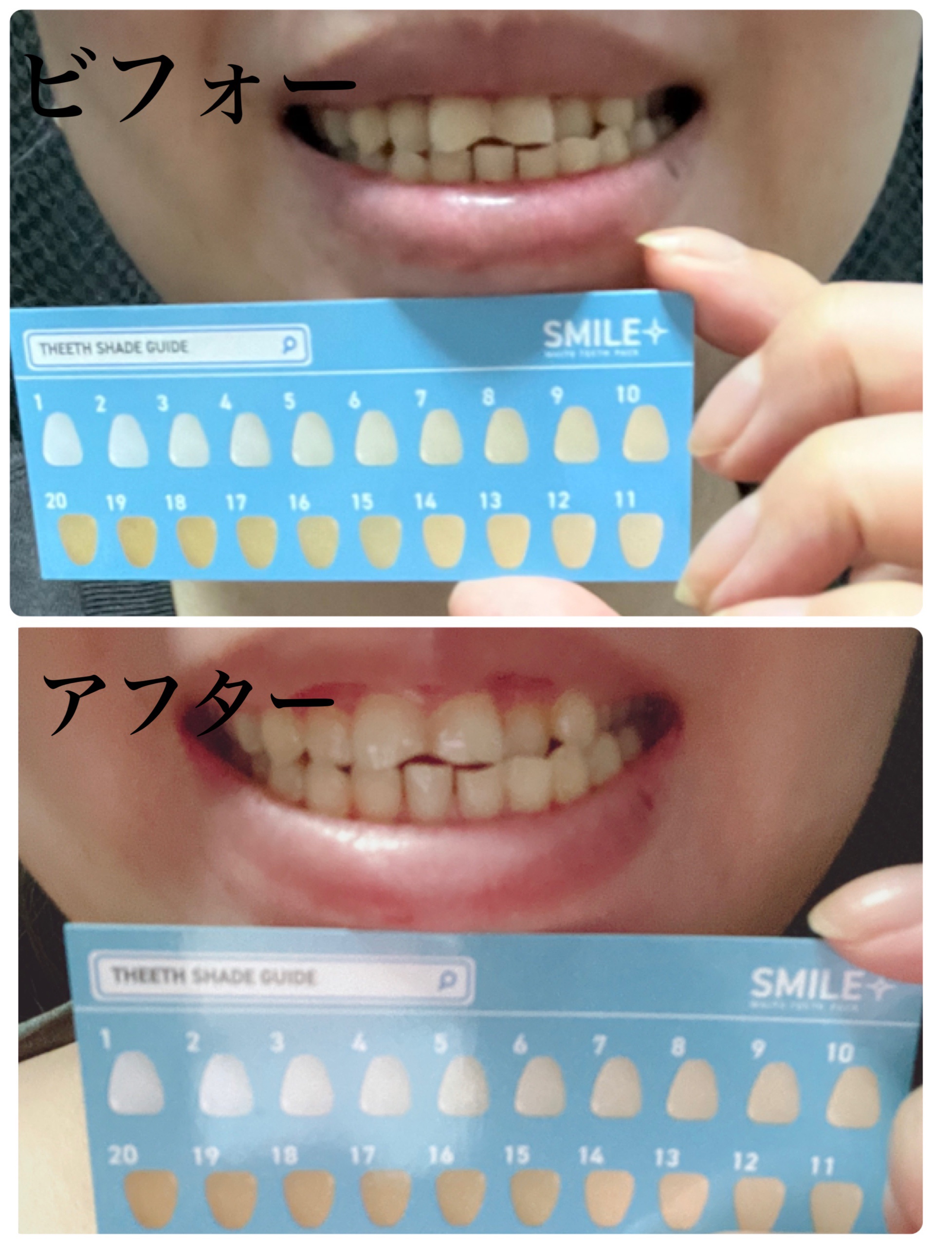 美歯シート/スマイルプラス/その他オーラルケアを使ったクチコミ（2枚目）