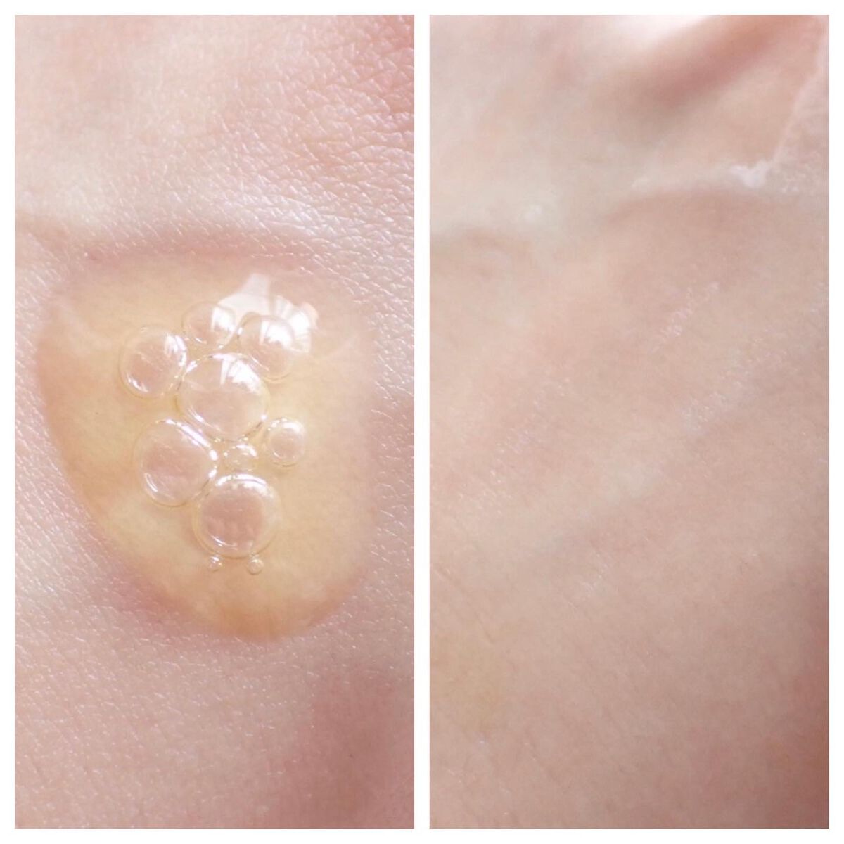 Big3 Step Whitening Mask Pack/MIGUHARA/シートマスク・パックを使ったクチコミ(5枚目)