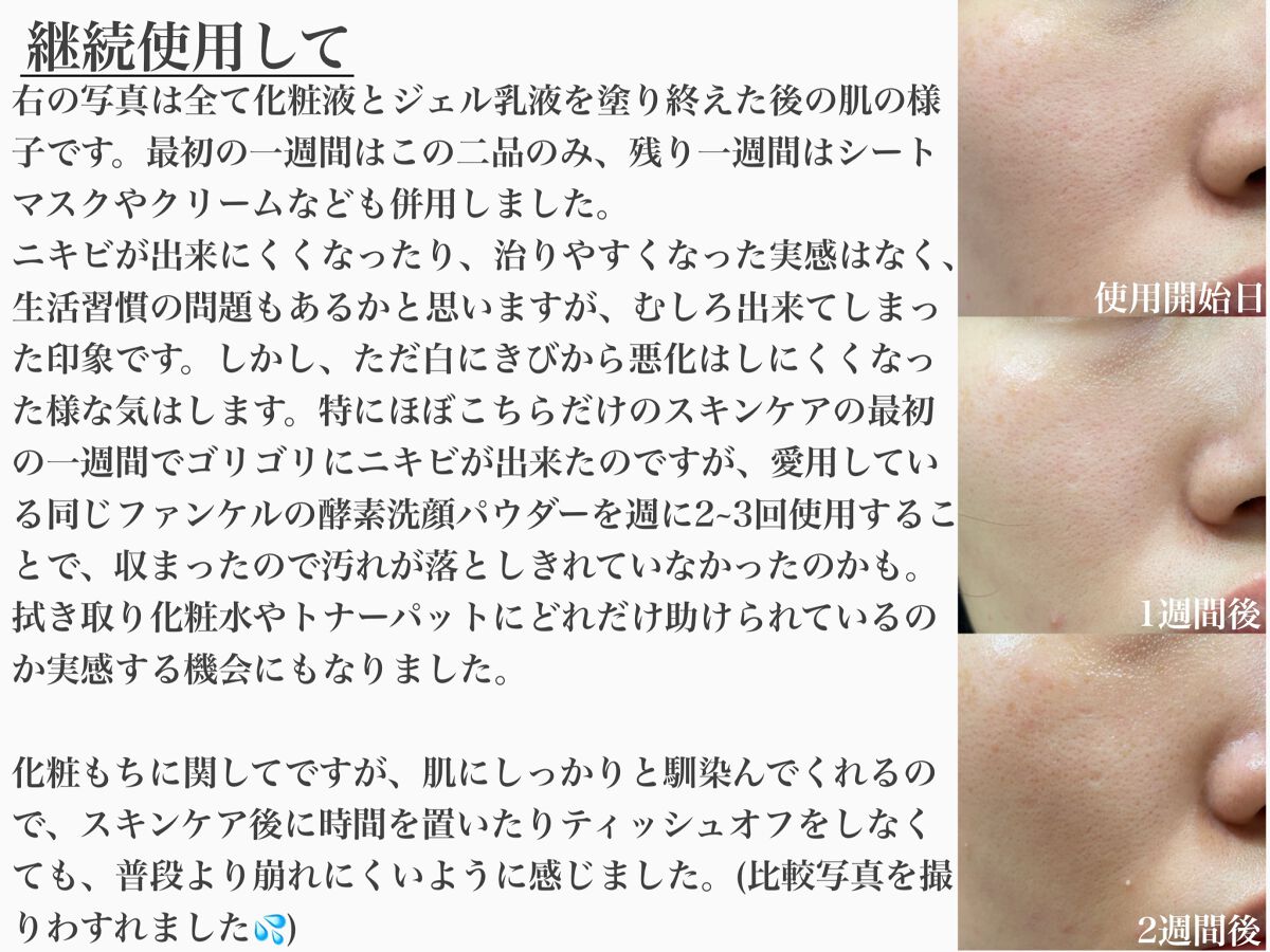 アクネケア 化粧液　＜医薬部外品＞/ファンケル/化粧水を使ったクチコミ（3枚目）