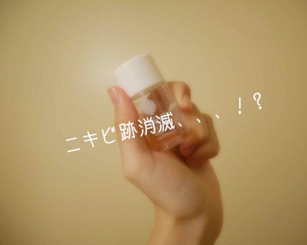 バイオイル/バイオイル/フェイスオイルを使ったクチコミ(1枚目)