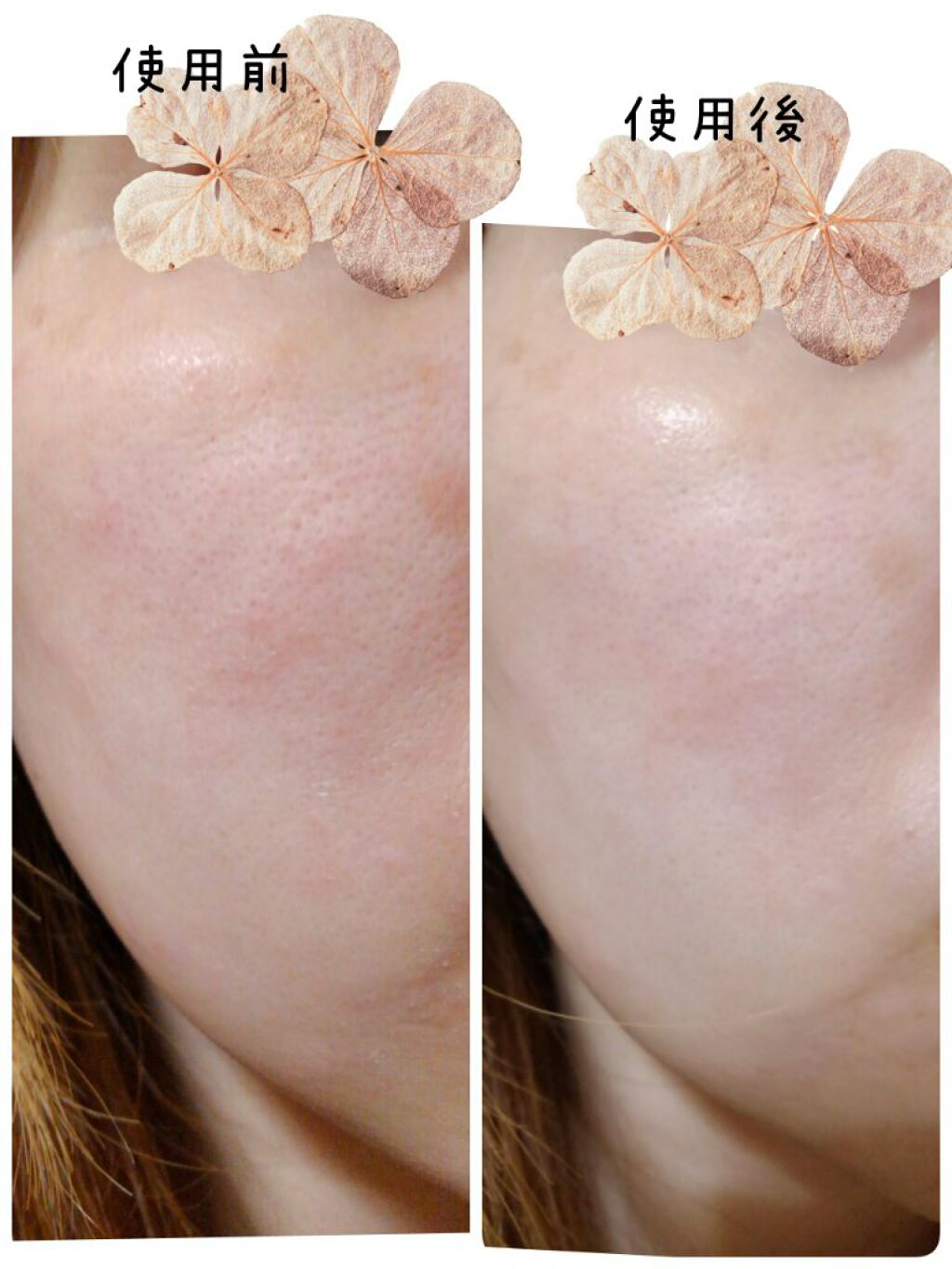 FACE MASK Premium/HIRONDELLE/シートマスク・パックを使ったクチコミ(5枚目)