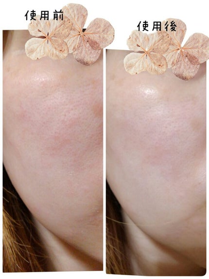 FACE MASK Premium/HIRONDELLE/シートマスク・パックを使ったクチコミ(5枚目)