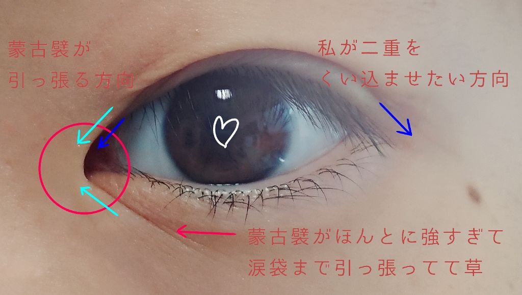 アイラッシュフィクサーEX 552/D-UP/つけまつげを使ったクチコミ（2枚目）