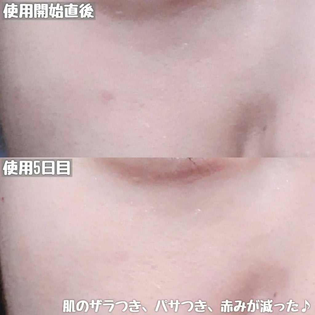 リードルショット100/VT/美容液を使ったクチコミ(7枚目)