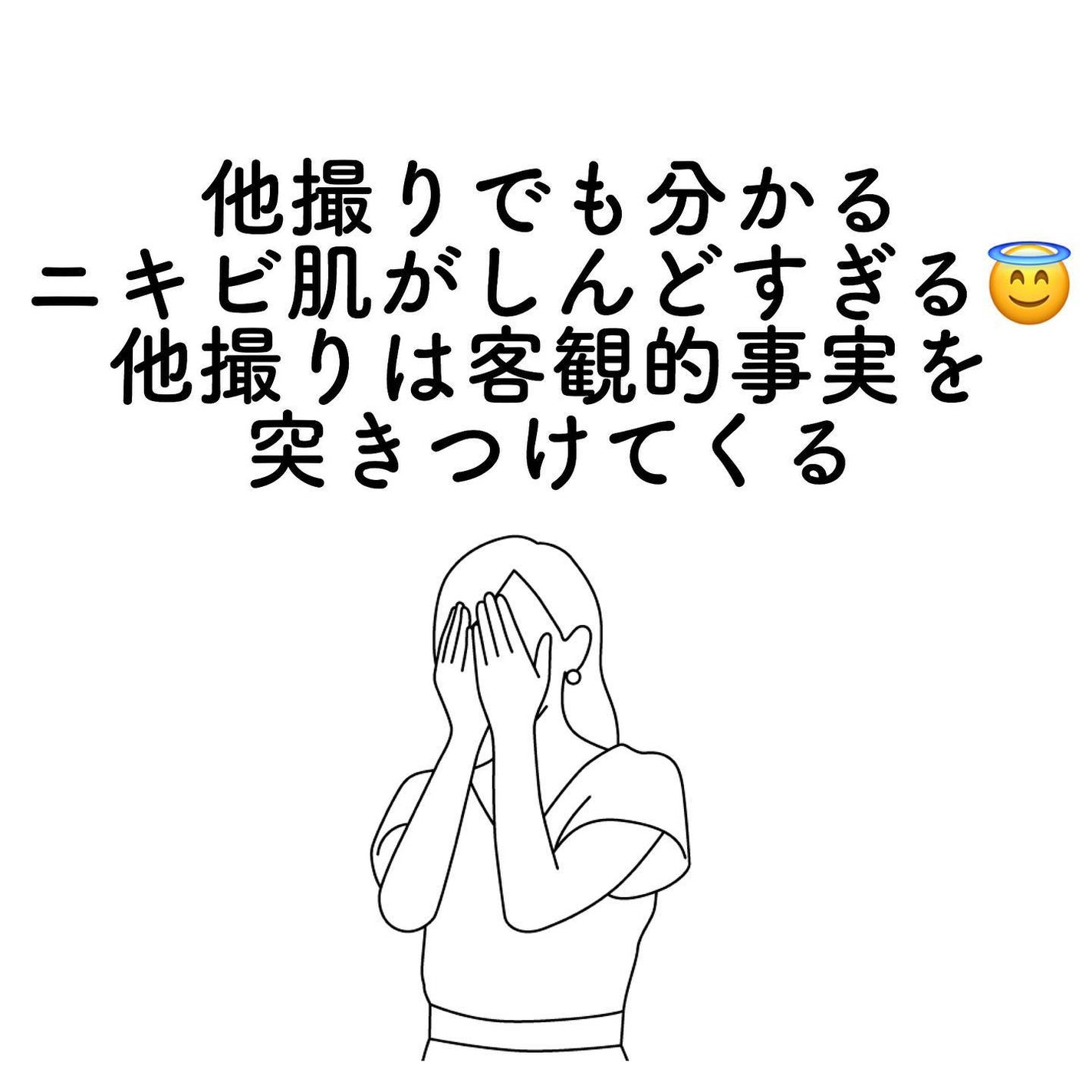 おゆみ|ニキビ・ニキビ跡ケア on LIPS 「【猛烈ニキビに悩んだ女子&悩み中の女子に捧げる!】わか..」(5枚目)