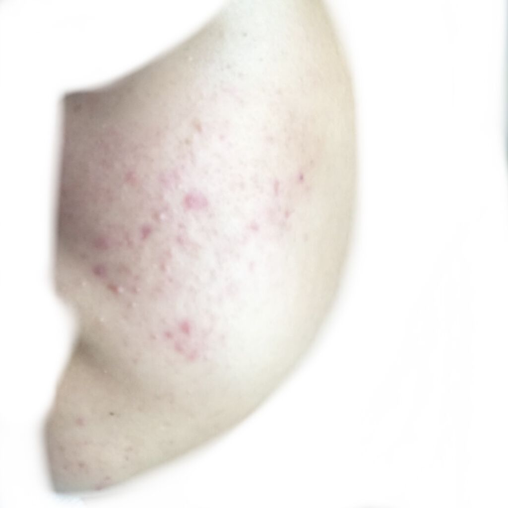 デュオ ザ クレンジングバーム クリア/DUO/クレンジングバームを使ったクチコミ（3枚目）