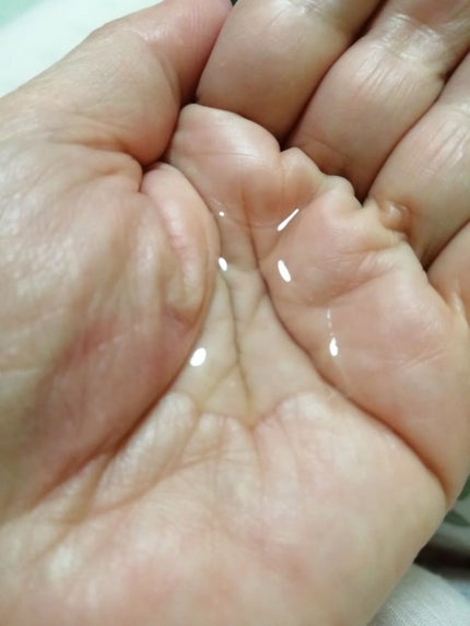 モイストケア ローション MB/d プログラム/化粧水を使ったクチコミ(3枚目)