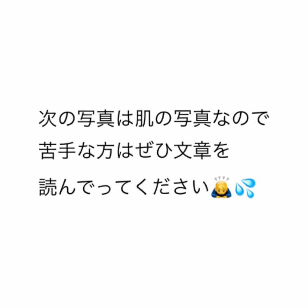 ハトムギ化粧水(ナチュリエ スキンコンディショナー R )/ナチュリエ/化粧水を使ったクチコミ（3枚目）