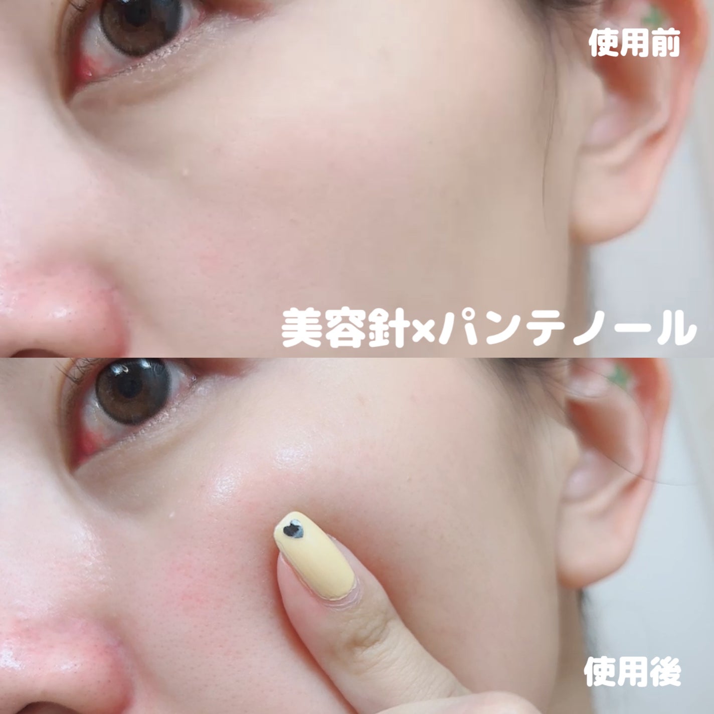 パンテショット675/COSNORI/美容液を使ったクチコミ(5枚目)