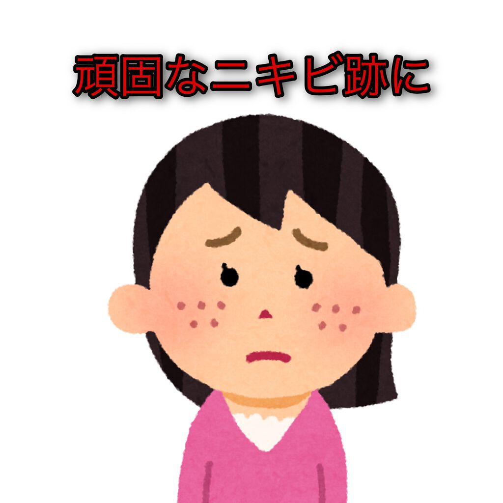 fサインディフェンス リペアランススポッツアクネ/AYURA/美容液を使ったクチコミ(1枚目)