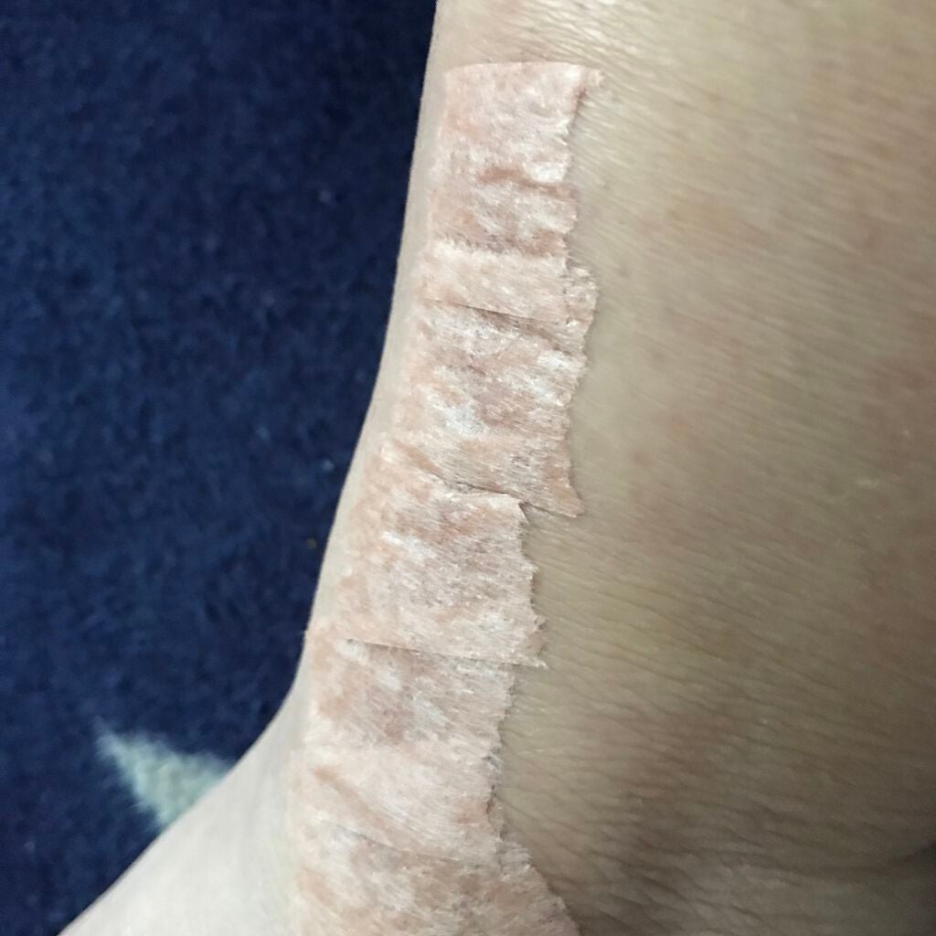 マイクロポア/3M nexcare/その他を使ったクチコミ(2枚目)