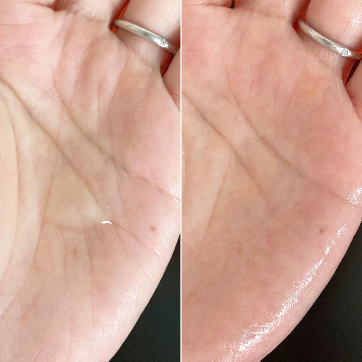 VC100エッセンスローション EX/ドクターシーラボⓇ/化粧水を使ったクチコミ（3枚目）