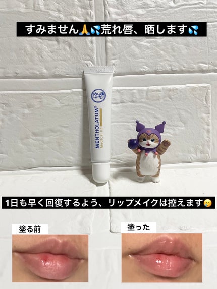 メディカルリップnc(医薬品)/メンソレータム/その他を使ったクチコミ(6枚目)