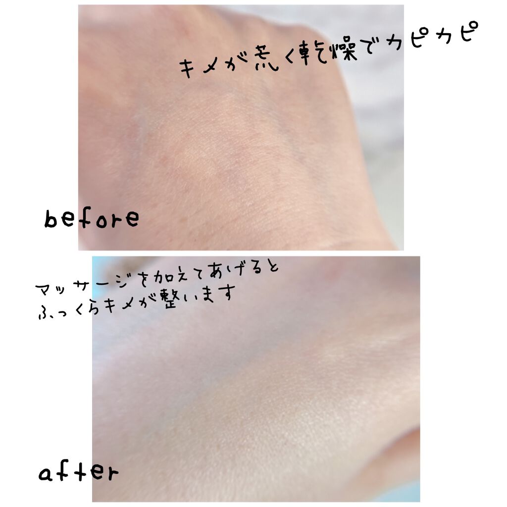 ハンドオイル/para spa/ハンドクリームを使ったクチコミ(5枚目)