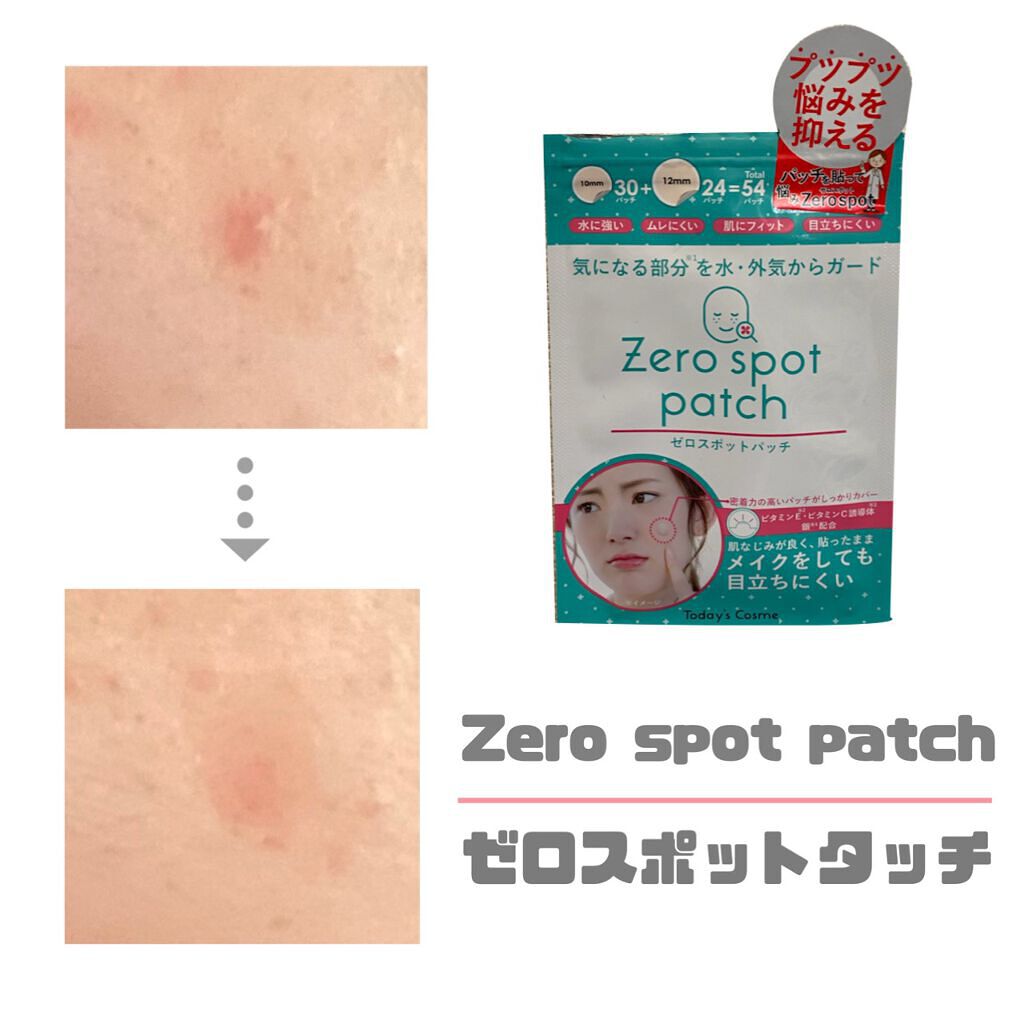 ゼロスポットパッチ/Today’s Cosme/にきびパッチを使ったクチコミ(1枚目)