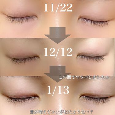 アイラッシュ コンディショニング セラム ラッシュアディクトの効果に関する口コミ Lashaddictアイラッシュコンディシ By おこめ フォロバ強化 30代前半 Lips