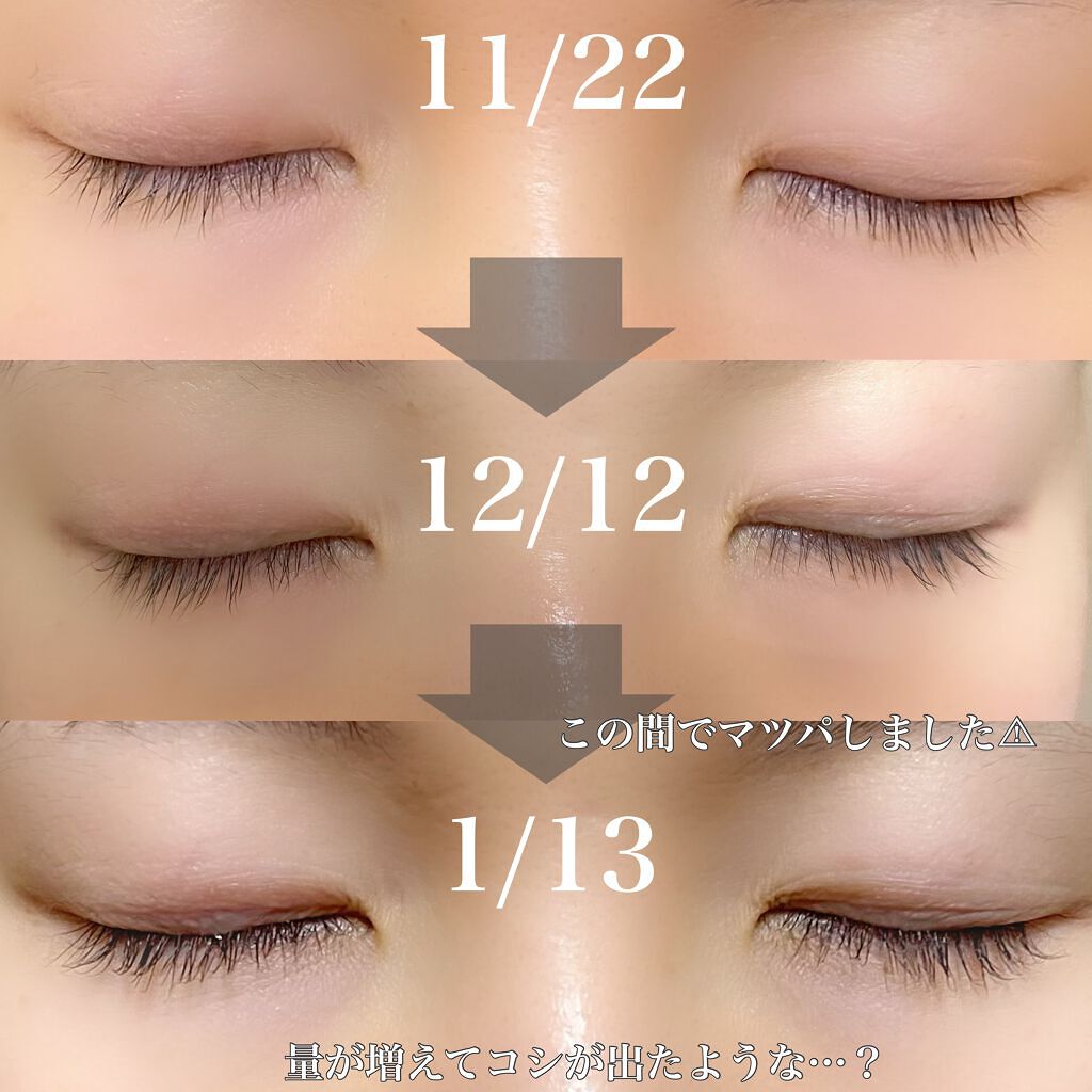 ラッシュアディクト アイラッシュコンディショニングセラム/soaddicted/まつげ美容液を使ったクチコミ(2枚目)