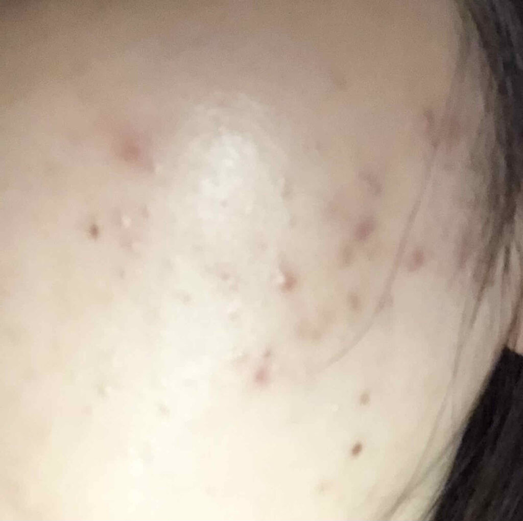 を使ったクチコミ（2枚目）