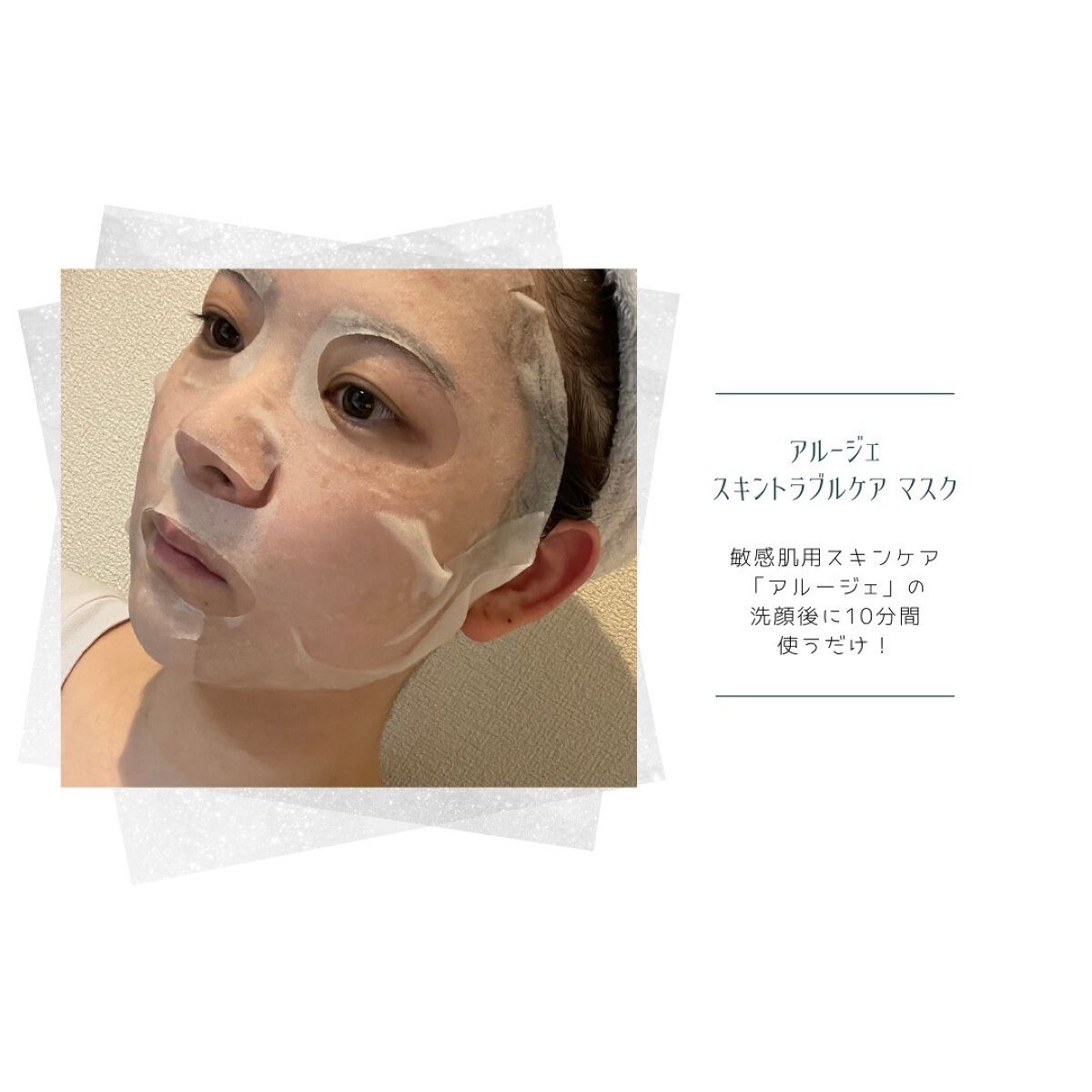 スキントラブルケア マスク/アルージェ/シートマスク・パックを使ったクチコミ（3枚目）