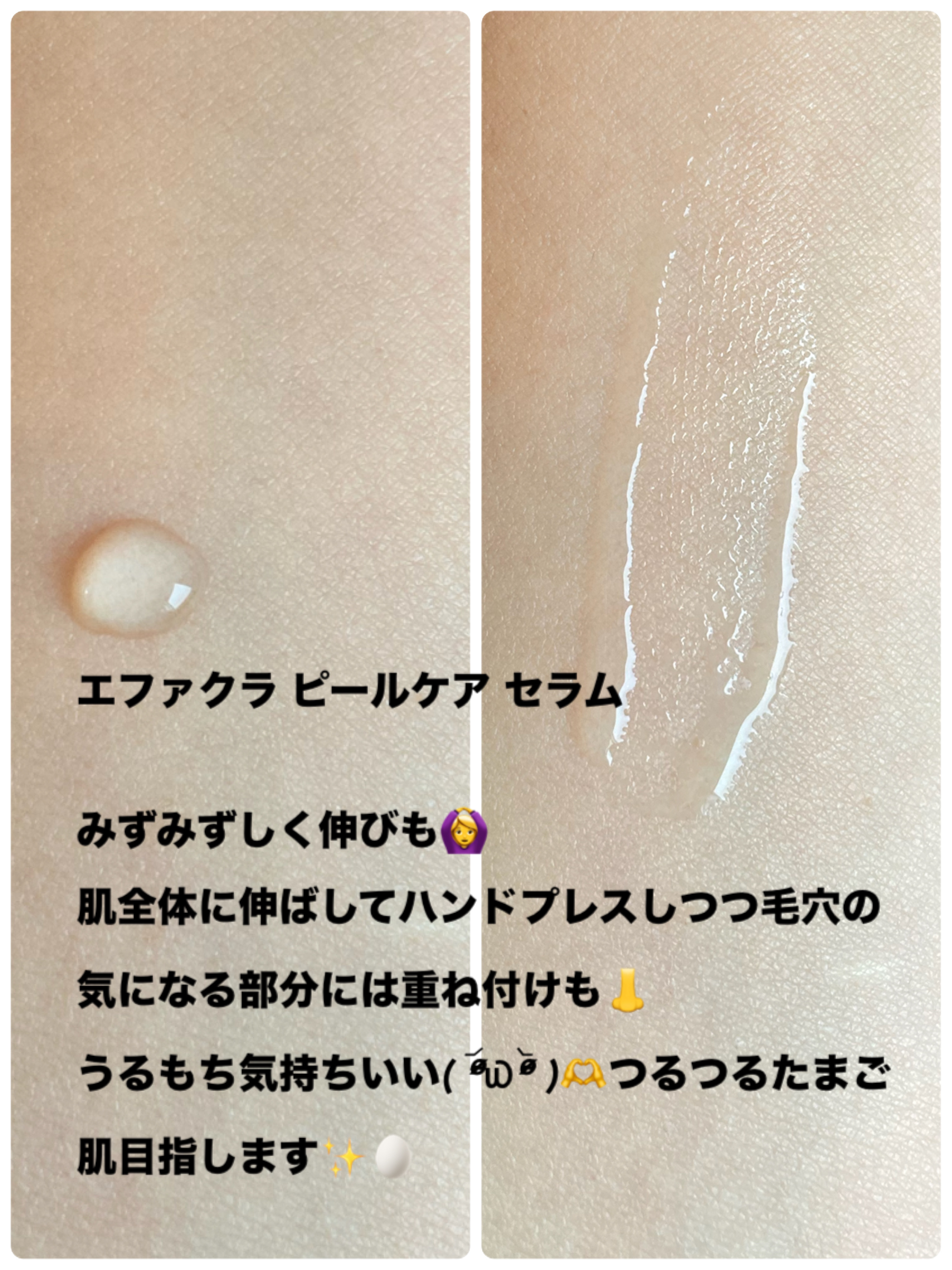 エファクラ ピールケア セラム/ラ ロッシュ ポゼ/美容液を使ったクチコミ（3枚目）