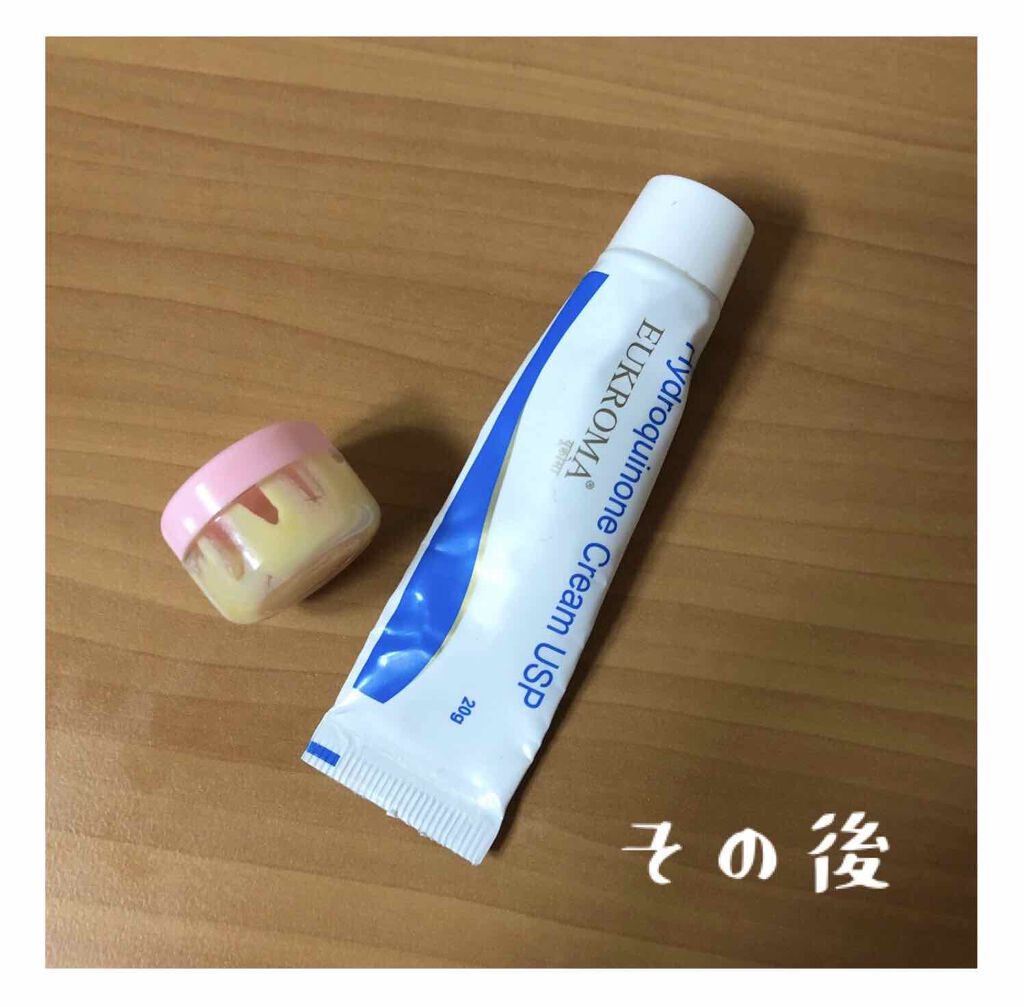 EUKROMA ハイドロキノンクリーム4% 20g/EUKROMA/その他スキンケアを使ったクチコミ(1枚目)