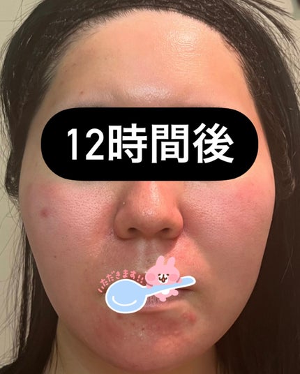 DW-EGF CREAM PRESSOME/Easydew/フェイスクリームを使ったクチコミ(3枚目)