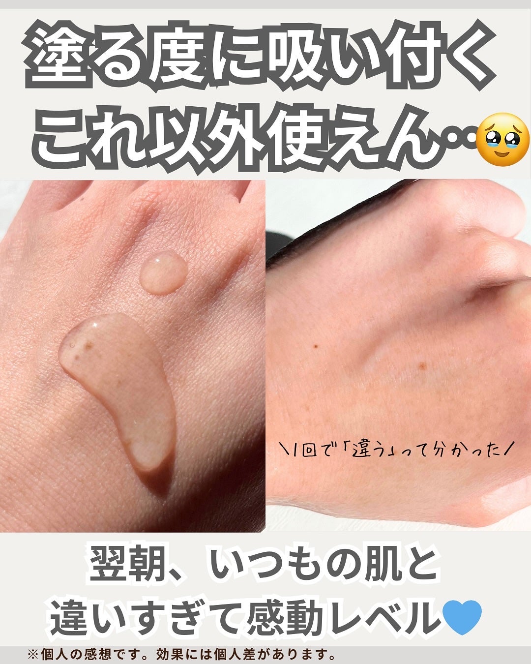 アクアヒアルロニックエッセンス/ロベクチン/化粧水を使ったクチコミ(3枚目)