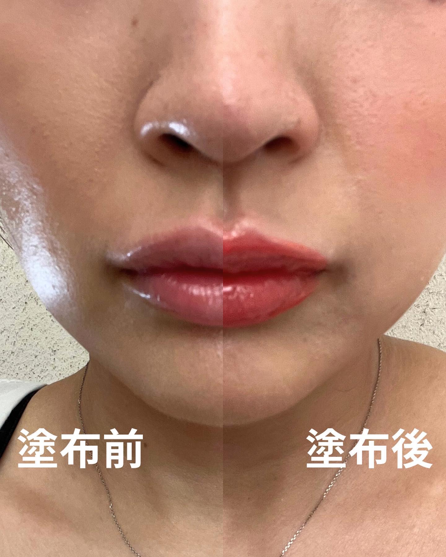 ジューシーリッププラスプランパー Apricot/keybo/リッププランパーを使ったクチコミ（3枚目）