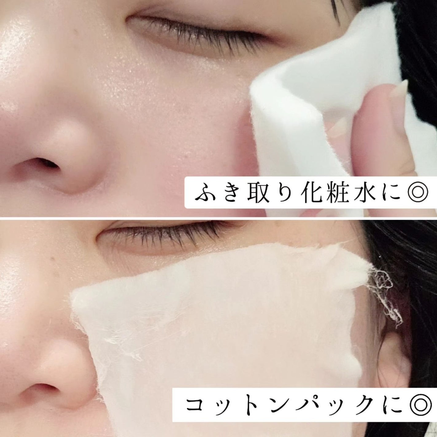 ピンクティーツリートナー/APLIN/化粧水を使ったクチコミ(3枚目)