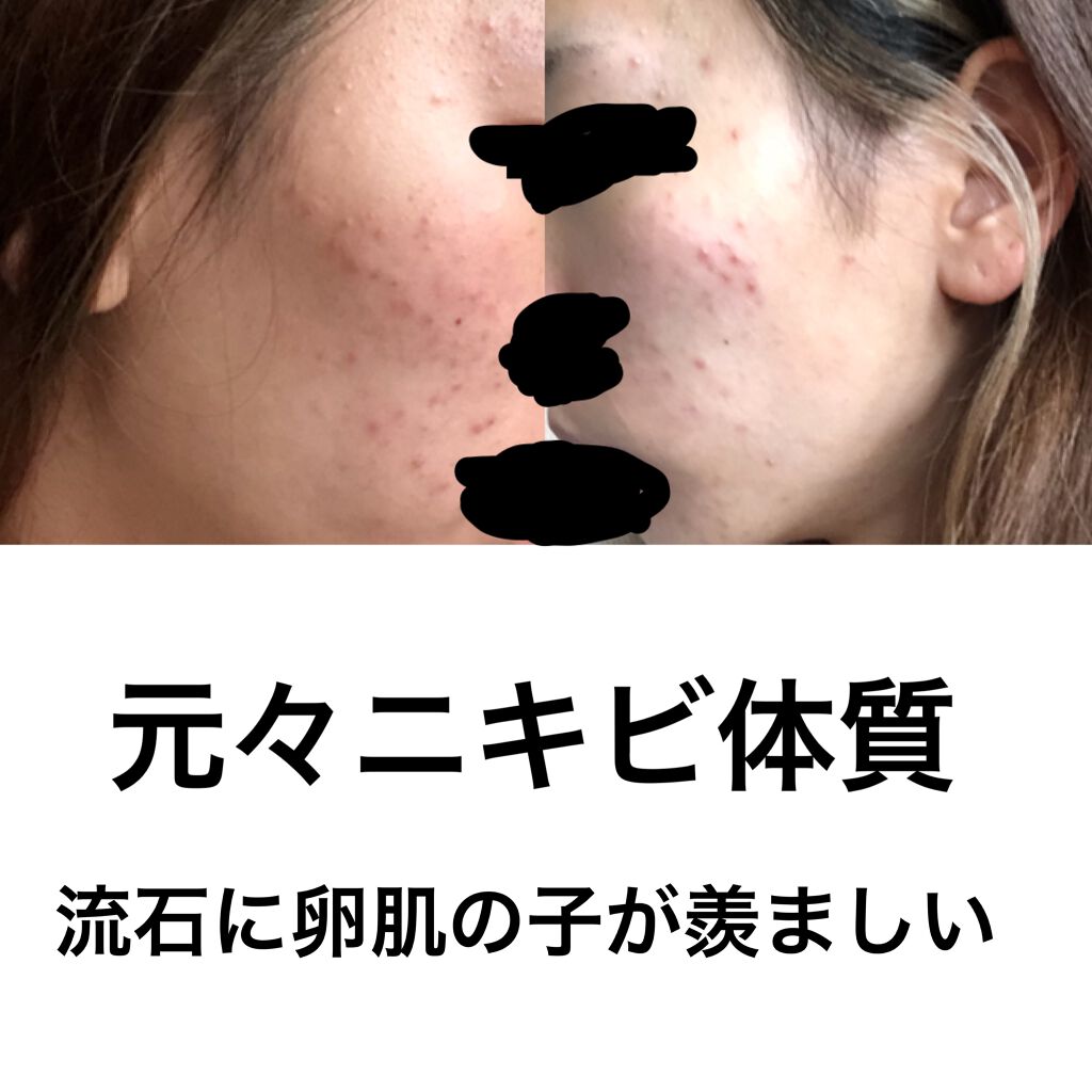 デュオ ザ クレンジングバーム ホワイトa/DUO/クレンジングバームを使ったクチコミ(1枚目)