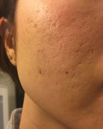 DS ライン コンセントレート 12.5 C/Kiehl's/美容液を使ったクチコミ(4枚目)