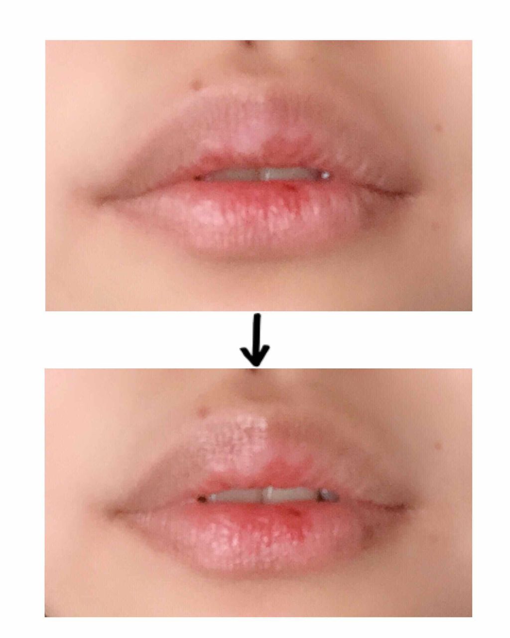 UV モイスチュア リップクリーム/DHC/リップクリームを使ったクチコミ(2枚目)