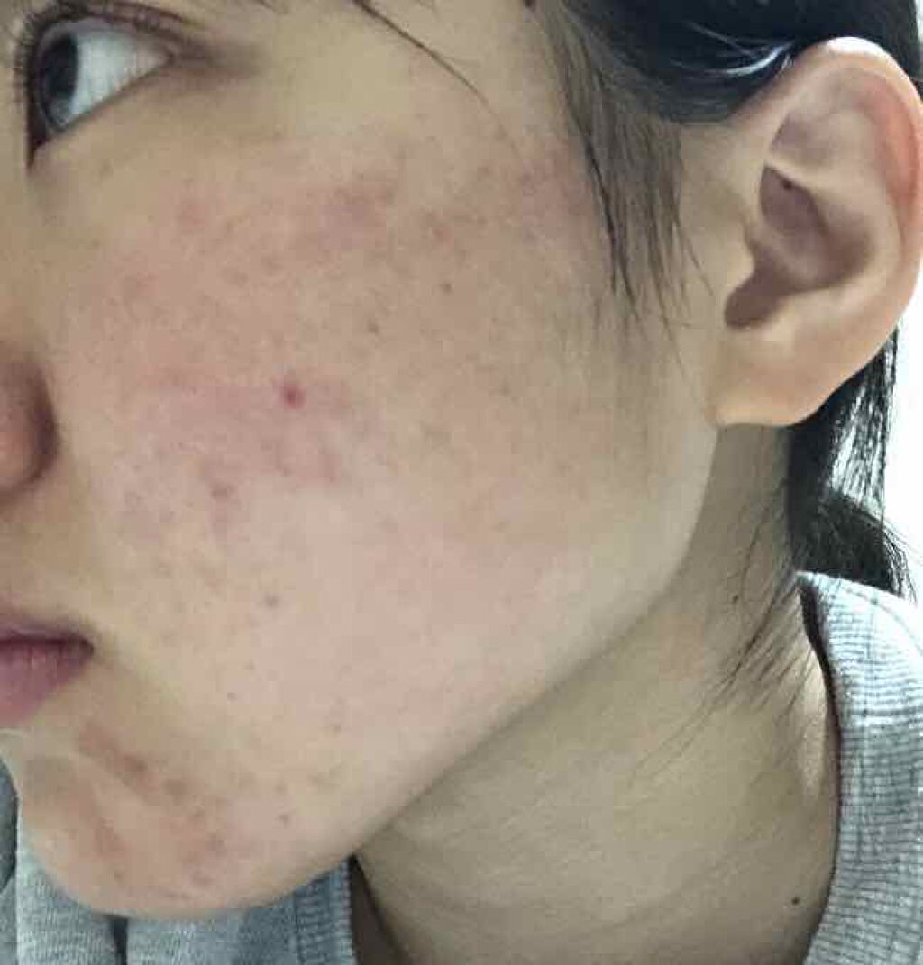 onigirið on LIPS ããã«ããã§ãïŒä»åã¯ç§ã®ãã£ãšæ¹åããªãã£ãã«ãã³ãããã¡ã®ã..ãïŒ3æç®ïŒ