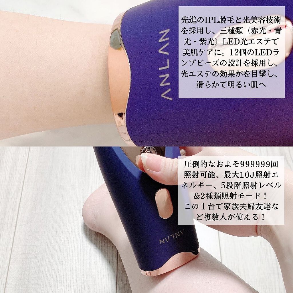 光美容器 IPL脱毛器/ANLAN/家庭用脱毛器を使ったクチコミ(2枚目)