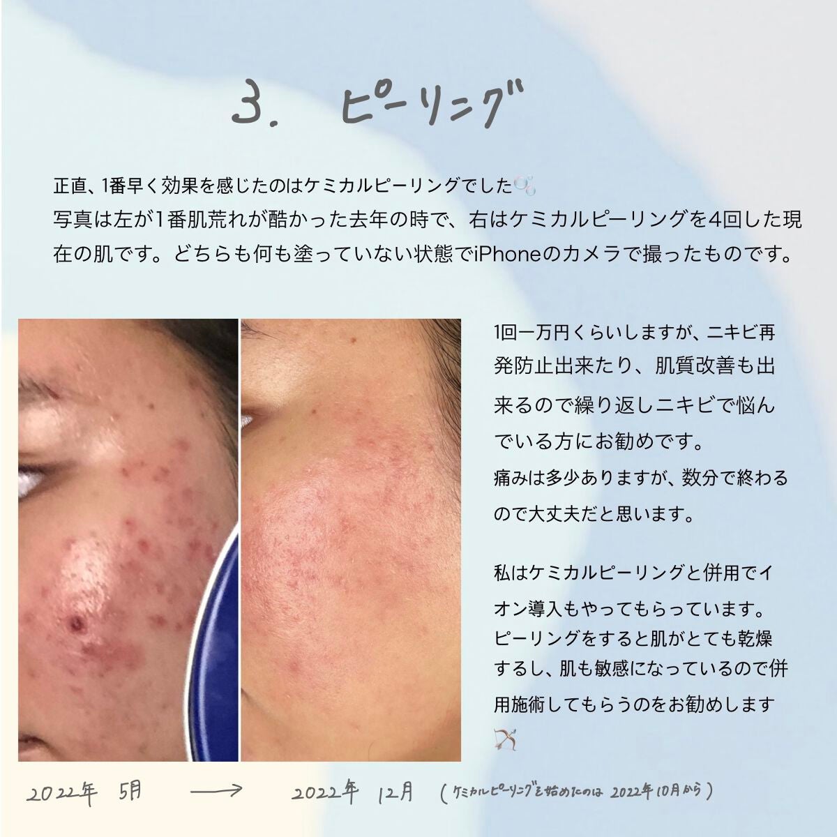 化粧水 敏感肌用 さっぱりタイプ/無印良品/化粧水を使ったクチコミ(4枚目)