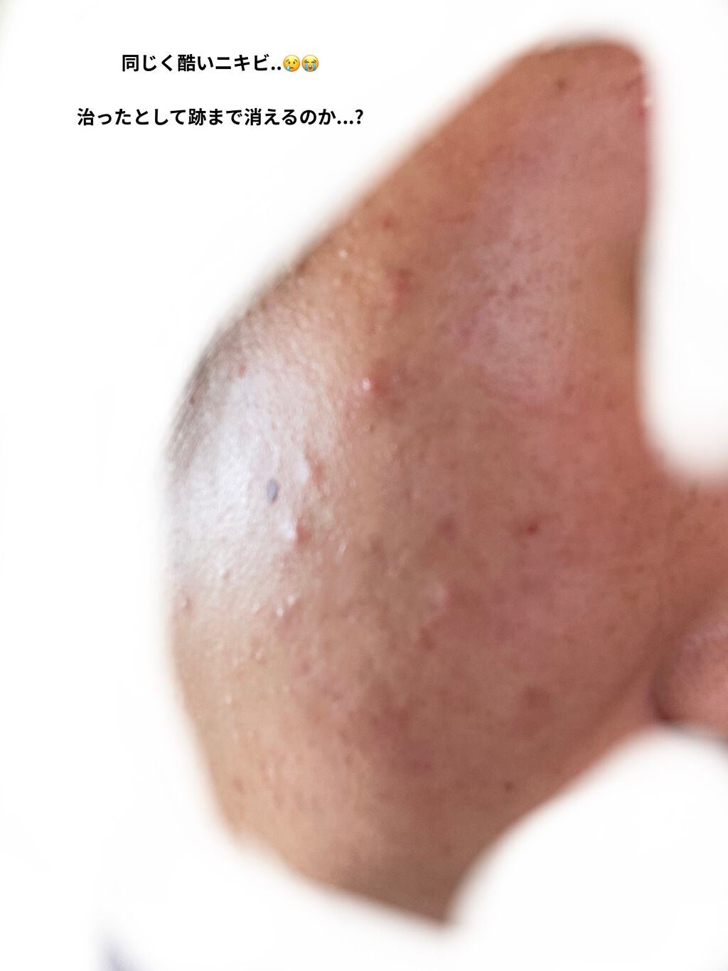 メイク落としジェル/オードムーゲ/クレンジングジェルを使ったクチコミ(3枚目)