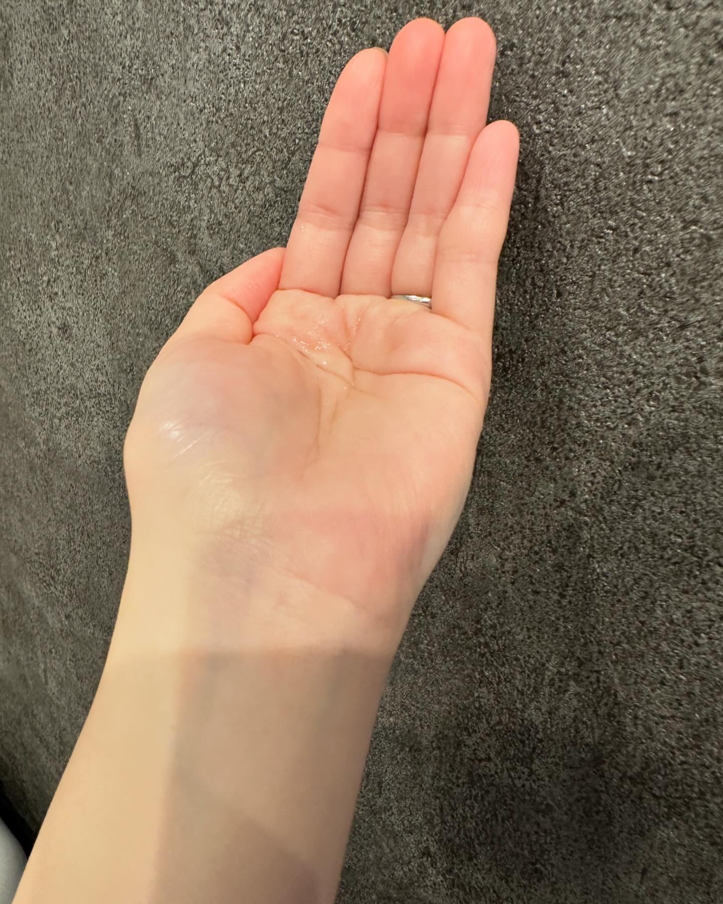 チャップアップ育毛ローション/CHAP UP(チャップアップ)/頭皮ローションを使ったクチコミ（2枚目）