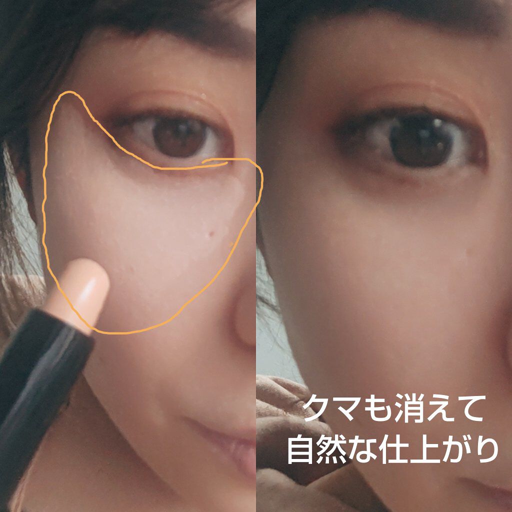 アイゾーン クリエイター/ブリリアージュ/スティックコンシーラーを使ったクチコミ（2枚目）