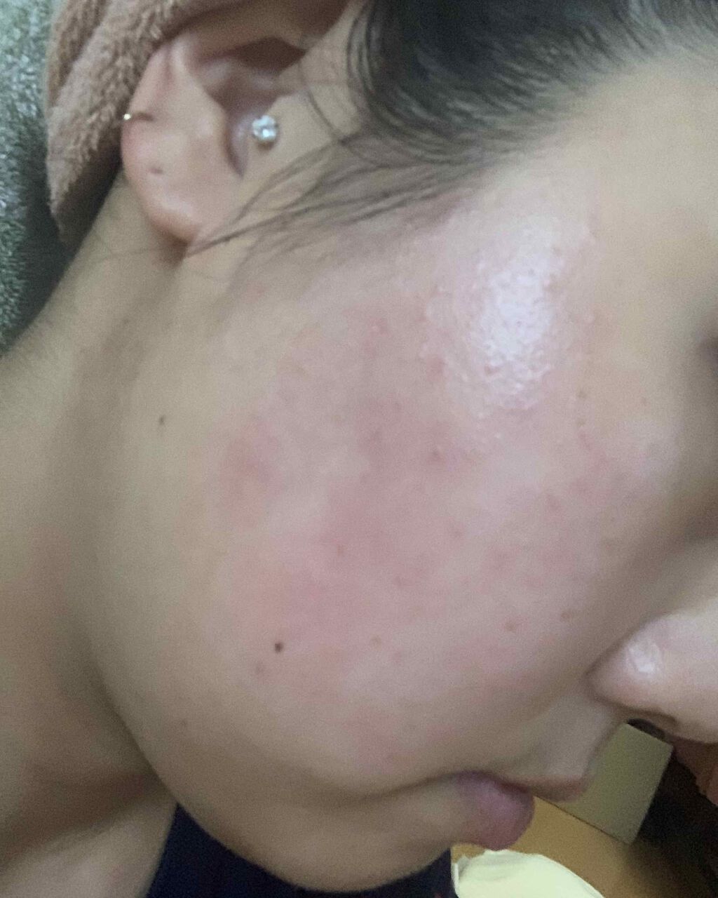 イハダ 薬用バーム【医薬部外品】/IHADA/フェイスバームを使ったクチコミ(1枚目)