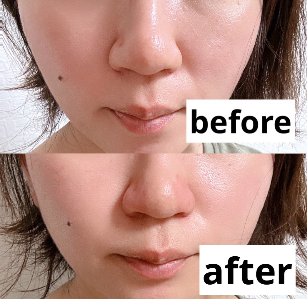 Fornez(フォーネス)/LUXCEAR/美顔器・マッサージを使ったクチコミ(5枚目)