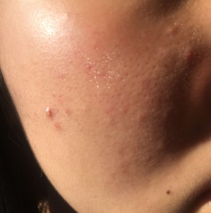 ð¥âðððððã¡ããð¥ on LIPS ã誰ãå©ããŠãã ããððçããã©ããªã¹ãã³ã±ã¢ããŠãŸããïŒ/çæŽ»..ãïŒ4æç®ïŒ