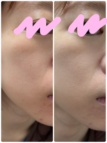 SPステイ クリームパクト ファンデーション/MAYBELLINE NEW YORK/クリーム・エマルジョンファンデーションを使ったクチコミ(5枚目)