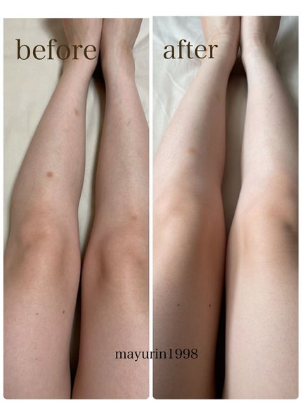 寝ながらメディキュット フルレッグ EX/メディキュット/着圧ソックス・レギンスを使ったクチコミ(3枚目)