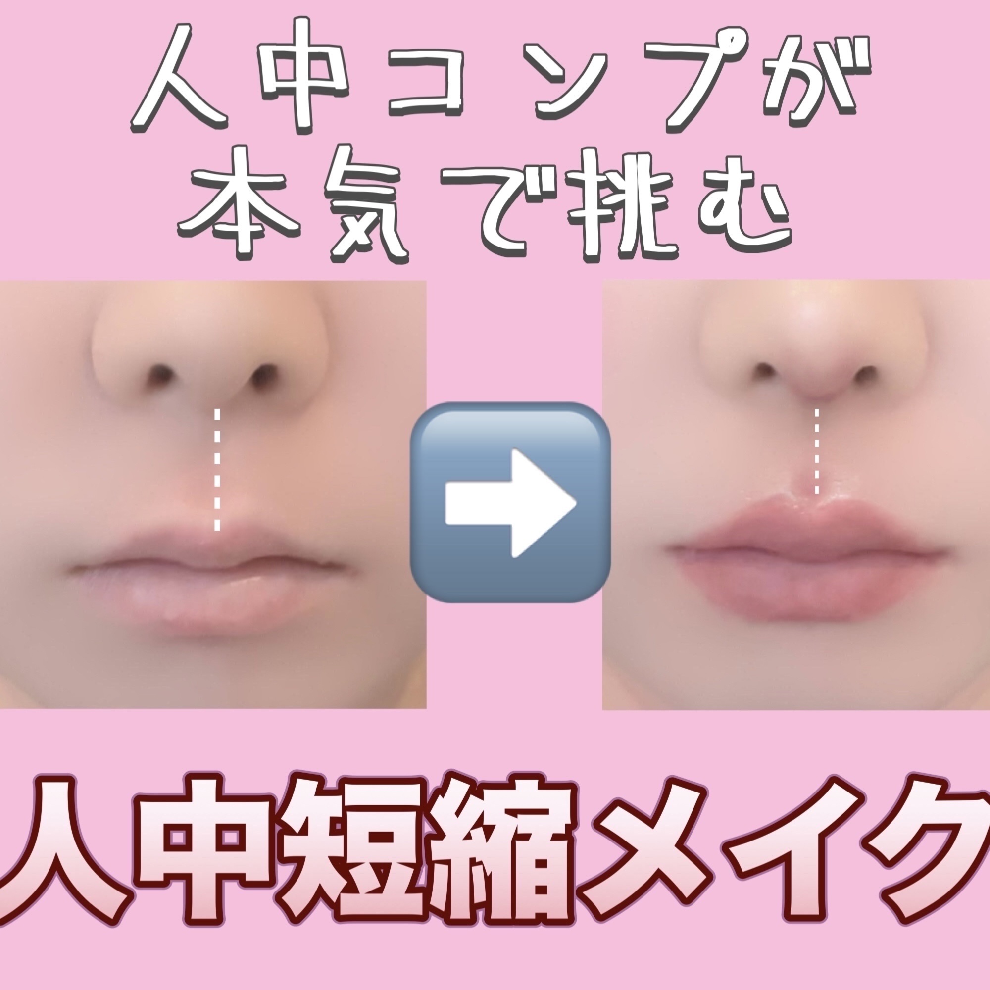 フィクシングティント/ETUDE/リップティントを使ったクチコミ（1枚目）