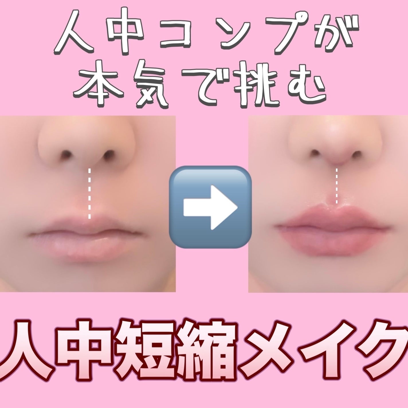 フィクシングティント/ETUDE/リップティントを使ったクチコミ(1枚目)