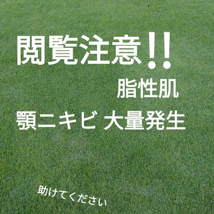 レッドブレミッシュ クリアスージングクリーム/Dr.G/フェイスクリームを使ったクチコミ(1枚目)