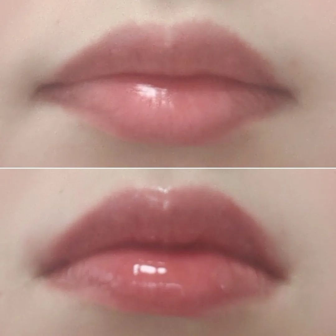 ボリュームリッププランパー/BANILA CO/リッププランパーを使ったクチコミ（2枚目）