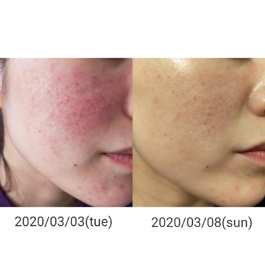 サンシビオ エイチツーオー D/ビオデルマ/クレンジングウォーターを使ったクチコミ(2枚目)